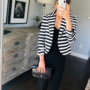 Black and White Striped Blazer